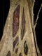 Choker ficus